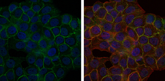 BLNK Antibody - Immunofluorescence of HepG2 cells using BLNK mouse monoclonal antibody (green). Blue: DRAQ5 fluorescent DNA dye. Red: Actin filaments have been labeled with Alexa Fluor-555 phalloidin.