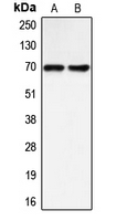 BLNK Antibody - Western blot analysis of BLNK expression in Raji (A); LOVO (B) whole cell lysates.
