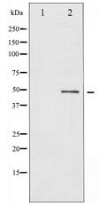BLNK Antibody - Western blot of BLNK expression in etoposide treated 293 whole cell lysates,The lane on the left is treated with the antigen-specific peptide.