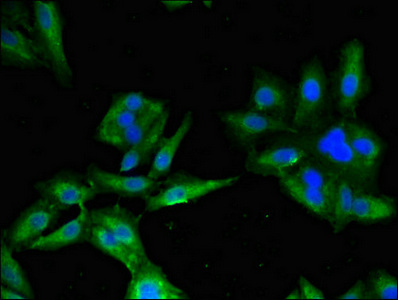 BLNK Antibody - Immunofluorescent analysis of Hela cells diluted at 1:100 and Alexa Fluor 488-congugated AffiniPure Goat Anti-Rabbit IgG(H+L)