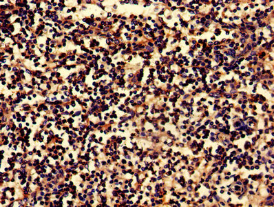 BLNK Antibody - Immunohistochemistry Dilution at 1:800 and staining in paraffin-embedded human spleen tissue performed on a Leica BondTM system. After dewaxing and hydration, antigen retrieval was mediated by high pressure in a citrate buffer (pH 6.0). Section was blocked with 10% normal Goat serum 30min at RT. Then primary antibody (1% BSA) was incubated at 4°C overnight. The primary is detected by a biotinylated Secondary antibody and visualized using an HRP conjugated SP system.
