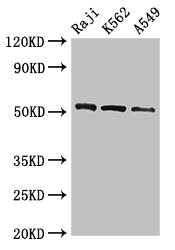 BLNK Antibody - Western Blot Positive WB detected in:Raji whole cell lysate,K562 whole cell lysate,A549 whole cell lysate All Lanes:BLNK antibody at 2.7µg/ml Secondary Goat polyclonal to rabbit IgG at 1/50000 dilution Predicted band size: 51,49,45 KDa Observed band size: 51 KDa