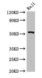 BLNK Antibody - Western Blot Positive WB detected in: Raji whole cell lysate All lanes: BLNK antibody at 2.7µg/ml Secondary Goat polyclonal to rabbit IgG at 1/50000 dilution Predicted band size: 51, 49, 45 kDa Observed band size: 51 kDa