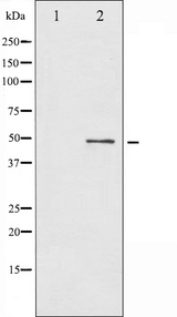 BLNK Antibody - Western blot analysis of BLNK expression in etoposide treated 293 whole cells lysates. The lane on the left is treated with the antigen-specific peptide.