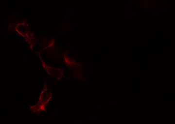 BLNK Antibody - Staining COLO205 cells by IF/ICC. The samples were fixed with PFA and permeabilized in 0.1% Triton X-100, then blocked in 10% serum for 45 min at 25°C. The primary antibody was diluted at 1:200 and incubated with the sample for 1 hour at 37°C. An Alexa Fluor 594 conjugated goat anti-rabbit IgG (H+L) antibody, diluted at 1/600, was used as secondary antibody.