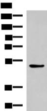 BLNK Antibody - Western blot analysis of LOVO cell lysate  using BLNK Polyclonal Antibody at dilution of 1:600