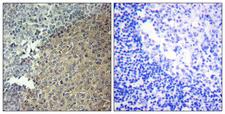 BLNK Antibody - Peptide - + Immunohistochemistry analysis of paraffin-embedded human tonsil tissue using BLNK (Ab-96) antibody.