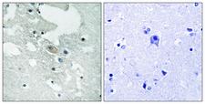 BLNK Antibody - Immunohistochemistry analysis of paraffin-embedded human brain, using BLNK (Phospho-Tyr84) Antibody. The picture on the right is blocked with the phospho peptide.