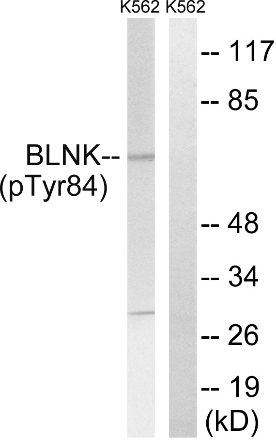 BLNK Antibody - Western blot analysis of lysates from K562 cells treated with starved 24h, using BLNK (Phospho-Tyr84) Antibody. The lane on the right is blocked with the phospho peptide.