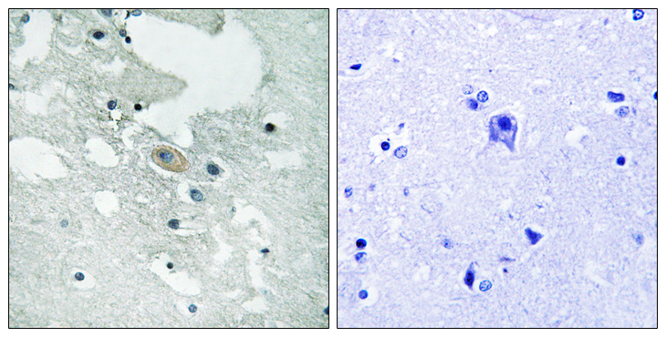 BLNK Antibody - Immunohistochemistry of paraffin-embedded human brain tissue using BLNK (Phospho-Tyr84) antibody.