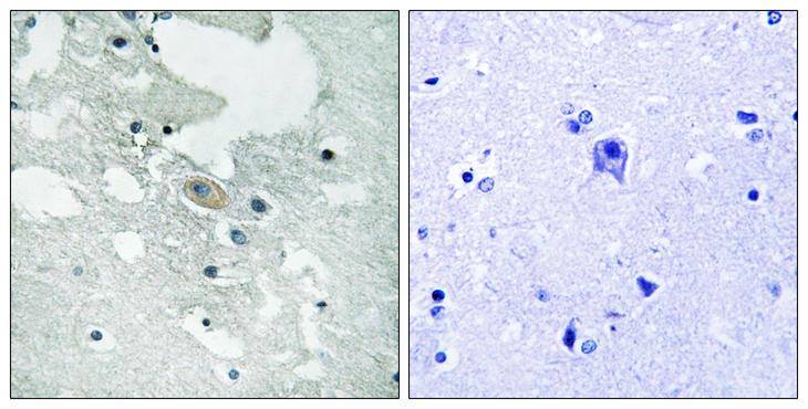 BLNK Antibody - P-peptide - + Immunohistochemistry analysis of paraffin-embedded human brain tissue using BLNK (Phospho-Tyr84) antibody.
