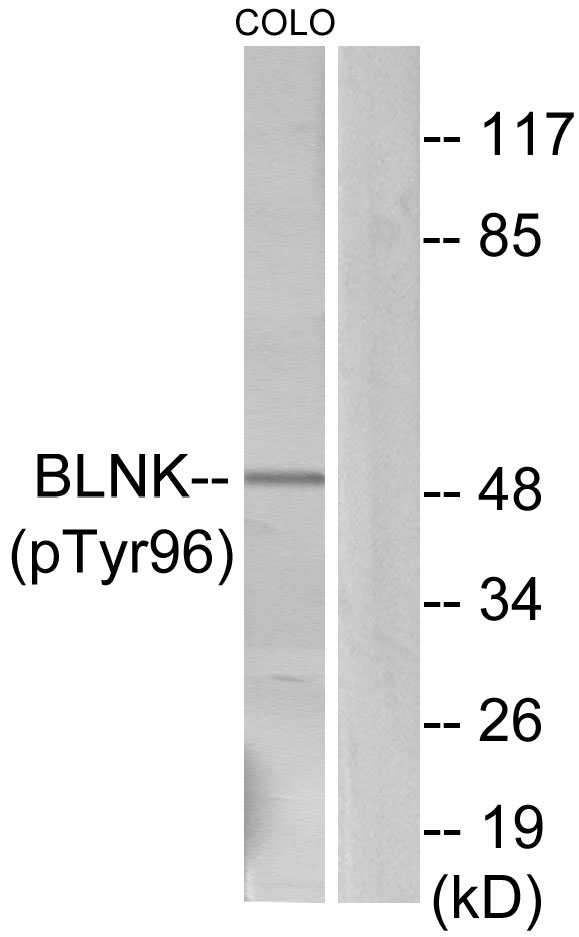 BLNK Antibody - Western blot analysis of lysates from COLO205 cells, using BLNK (Phospho-Tyr96) Antibody. The lane on the right is blocked with the phospho peptide.