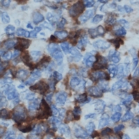 BLNK Antibody - Immunohistochemical analysis of BLNK (pY96) staining in human lymph node formalin fixed paraffin embedded tissue section. The section was pre-treated using heat mediated antigen retrieval with sodium citrate buffer (pH 6.0). The section was then incubated with the antibody at room temperature and detected using an HRP polymer system. DAB was used as the chromogen. The section was then counterstained with hematoxylin and mounted with DPX.