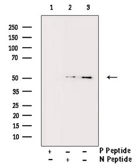 BLNK Antibody - Western blot analysis of Phospho-BLNK (Tyr96) antibody expression in COLO205 cells lysates. The lane on the right is treated with the antigen-specific peptide.