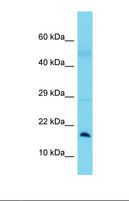 BLOC1S1 Antibody - Western blot of Human Lung Tumor. BLOC1S1 antibody dilution 1.0 ug/ml.  This image was taken for the unconjugated form of this product. Other forms have not been tested.