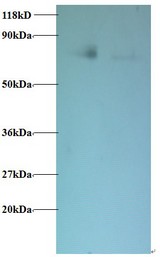 BLOC1S1 Antibody - Western blot of Biogenesis of lysosome-related organelles complex 1 subunit 1 antibody at 2 ug/ml. Lane 1: EC109 whole cell lysate. Lane 2: 293T whole cell lysate. Secondary: Goat polyclonal to Rabbit IgG at 1:15000 dilution. Predicted band size: 16 kDa. Observed band size: 75 kDa.  This image was taken for the unconjugated form of this product. Other forms have not been tested.
