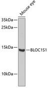 BLOC1S1 Antibody - Western blot analysis of extracts of mouse eye using BLOC1S1 Polyclonal Antibody at dilution of 1:1000.