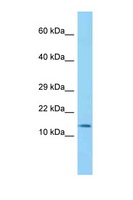 BLOC1S2 Antibody - BLOC1S2 antibody Western blot of Mouse Heart lysate. Antibody concentration 1 ug/ml.  This image was taken for the unconjugated form of this product. Other forms have not been tested.