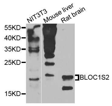 BLOC1S2 Antibody - Western blot analysis of extracts of various cells.