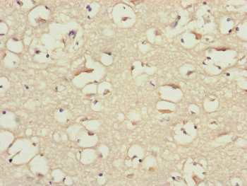 BLOC1S2 Antibody - Immunohistochemistry of paraffin-embedded human brain tissue at dilution of 1:100
