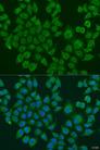 BLOC1S2 Antibody - Immunofluorescence analysis of U2OS cells using BLOC1S2 Polyclonal Antibody at dilution of 1:100.Blue: DAPI for nuclear staining.