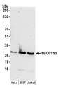 BLOC1S3 Antibody - Detection of human BLOC1S3 by western blot. Samples: Whole cell lysate (50 µg) from HeLa, HEK293T, and Jurkat cells prepared using NETN lysis buffer. Antibodies: Affinity purified rabbit anti-BLOC1S3 antibody used for WB at 0.1 µg/ml. Detection: Chemiluminescence with an exposure time of 3 minutes.