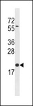 BLOC1S3 Antibody - BLOC1S3 Antibody western blot of A2058 cell line lysates (35 ug/lane). The BLOC1S3 antibody detected the BLOC1S3 protein (arrow).