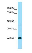 BLOC1S3 Antibody - BLOC1S3 antibody Western Blot of Human heart.  This image was taken for the unconjugated form of this product. Other forms have not been tested.