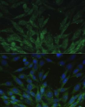 BLOC1S3 Antibody - Immunofluorescence analysis of NIH/3T3 cells using BLOC1S3 Polyclonal Antibody at dilution of 1:100.Blue: DAPI for nuclear staining.