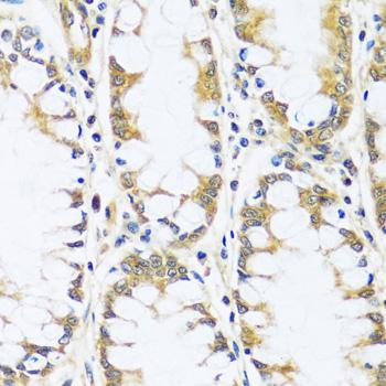 BLOC1S3 Antibody - Immunohistochemistry of paraffin-embedded Human colon using BLOC1S3 Polyclonal Antibody at dilution of 1:100 (40x lens).