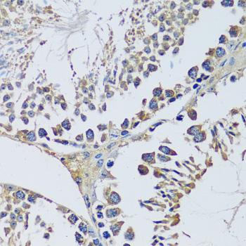 BLOC1S3 Antibody - Immunohistochemistry of paraffin-embedded Mouse testis using BLOC1S3 Polyclonal Antibody at dilution of 1:100 (40x lens).