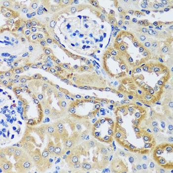 BLOC1S3 Antibody - Immunohistochemistry of paraffin-embedded Mouse kidney using BLOC1S3 Polyclonal Antibody at dilution of 1:100 (40x lens).