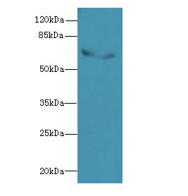 BLOM7 / KIAA0907 Antibody - Western blot. All lanes: KIAA0907 antibody at 5 ug/ml+ Mouse liver tissue Goat polyclonal to rabbit at 1:10000 dilution. Predicted band size: 65 kDa. Observed band size: 65 kDa.