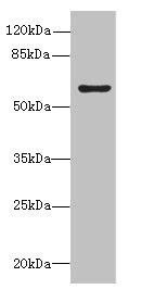 BLOM7 / KIAA0907 Antibody - Western blot All lanes: KIAA0907 antibody at 5µg/ml + Mouse liver tissue Secondary Goat polyclonal to rabbit IgG at 1/10000 dilution Predicted band size: 65, 60, 41, 25 kDa Observed band size: 65 kDa
