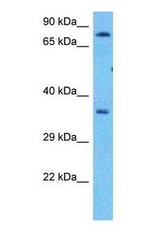 BLOM7 / KIAA0907 Antibody - Western blot of K0907 Antibody with human Fetal Lung lysate.  This image was taken for the unconjugated form of this product. Other forms have not been tested.
