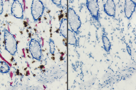 Product - Endogenous alkaline phosphatase (AP) and peroxidase (HRP) activities in frozen intestine revealed with Vector Red™ AP Substrate (red) and ImmPACT™ DAB HRP Substrate (brown) (left). Same substrates used on BLOXALL™ Solution-treated tissue (right). BLOXALL™ Block.