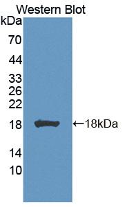 BLVRA Antibody - Western blot of BLVRA antibody.