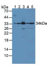 BLVRA Antibody - Western Blot; Sample: Lane1: Rat Serum; Lane2: Rat Brain Tissue; Lane3: Rat Liver Tissue; Lane4: Rat Lung Tissue; Lane5: Rat Kidney Tissue.