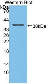 BLVRA Antibody - Western blot of BLVRA antibody.