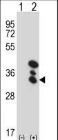 BLVRA Antibody - Western blot of BLVRA (arrow) using rabbit polyclonal BLVRA Antibody. 293 cell lysates (2 ug/lane) either nontransfected (Lane 1) or transiently transfected (Lane 2) with the BLVRA gene.