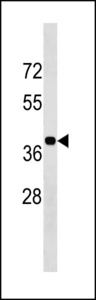 BLVRA Antibody - BLVRA Antibody (Center Y83) western blot of K562 cell line lysates (35 ug/lane). The BLVRA antibody detected the BLVRA protein (arrow).