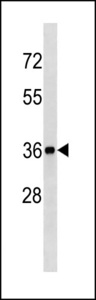 BLVRA Antibody - BLVRA Antibody (Center Y83) western blot of mouse kidney tissue lysates (35 ug/lane). The BLVRA antibody detected the BLVRA protein (arrow).