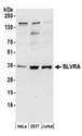 BLVRA Antibody - Detection of human BLVRA by western blot. Samples: Whole cell lysate (50 µg) from HeLa, HEK293T, and Jurkat cells prepared using NETN lysis buffer. Antibodies: Affinity purified rabbit anti-BLVRA antibody used for WB at 0.4 µg/ml. Detection: Chemiluminescence with an exposure time of 3 minutes.