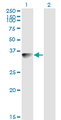 BLVRA Antibody - Western blot of BLVRA expression in transfected 293T cell line by BLVRA monoclonal antibody (M03), clone S2.