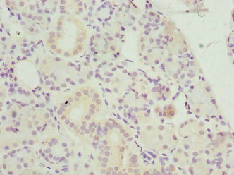 BLVRA Antibody - Immunohistochemistry of paraffin-embedded human pancreatic tissue at dilution 1:100