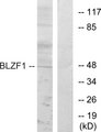 BLZF1 Antibody - Western blot analysis of lysates from Jurkat cells, using BLZF1 Antibody. The lane on the right is blocked with the synthesized peptide.