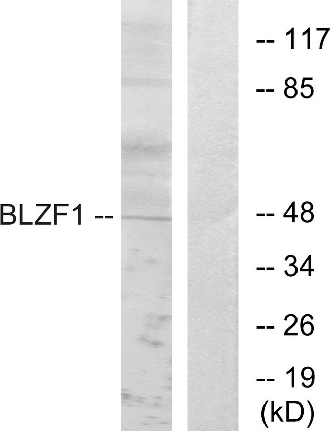 BLZF1 Antibody - Western blot analysis of lysates from Jurkat cells, using BLZF1 Antibody. The lane on the right is blocked with the synthesized peptide.