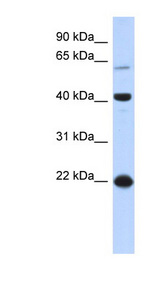 BLZF1 Antibody - BLZF1 antibody Western blot of Fetal Kidney lysate. This image was taken for the unconjugated form of this product. Other forms have not been tested.