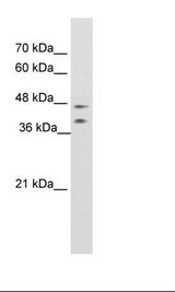 BLZF1 Antibody - Jurkat Cell Lysate.  This image was taken for the unconjugated form of this product. Other forms have not been tested.