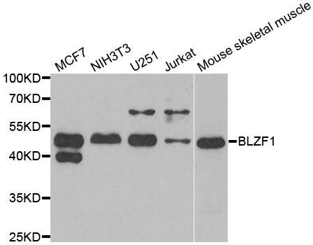 BLZF1 Antibody - Western blot analysis of extracts of various cell lines.